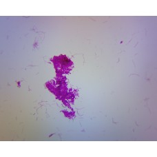 Slide, Microscope, Bacteria types